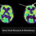 13 Cara Buat Otak Fokus Dan Tenang Ketika Menghadap Allah. 13 Cara Buat Otak Fokus Dan Tenang Ketika Menghadap Allah.