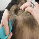 Inilah 12 Cara Hilangkan Kutu Rambut. Boleh Cuba! Inilah 12 Cara Hilangkan Kutu Rambut. Boleh Cuba!