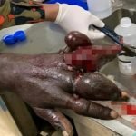 NGERI. 8 Cincin Melekat Pada Jari. NGERI. 8 Cincin Melekat Pada Jari.