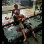 Pemilik Kedai Parah Diserang 4 Penyamun Pemilik Kedai Parah Diserang 4 Penyamun