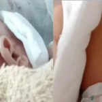 Bayi 2 Bulan Parah Digigit Dan Diseret Oleh Kera. Bayi 2 Bulan Parah Digigit Dan Diseret Oleh Kera.