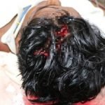 Gara-Gara Pintu Pagar, Dua Beranak Cedera Diserang Jiran Gara-Gara Pintu Pagar, Dua Beranak Cedera Diserang Jiran