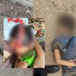 KEJAM. Bapa Saudara Tetak Kepala Bayi Perempuan Sampai Mati. KEJAM. Bapa Saudara Tetak Kepala Bayi Perempuan Sampai Mati.