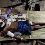 Seorang Lelaki Orang Asli Cedera Parah Diserang PAK BELANG. Seorang Lelaki Orang Asli Cedera Parah Diserang PAK BELANG.