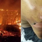 Enam Beranak Melecur Dalam Kebakaran Rumah Enam Beranak Melecur Dalam Kebakaran Rumah