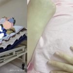 Wanita Hamil Koma Dipukul Suami Selamat Lahirkan Anak Secara Czer Wanita Hamil Koma Dipukul Suami Selamat Lahirkan Anak Secara Czer