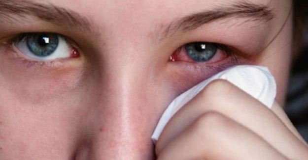 11 PUNCA Menyebabkan Sakit Mata Yang Perlu Anda Elakkan.