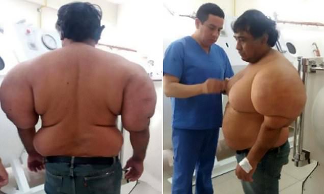 Lelaki Sengsara Badan Bengkak Berketul-ketul. Hasil Siasatan Doktor Lebih MENGEJUTKAN Lagi.