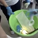 Apa Yang Doktor Keluarkan Dari Mulut Wanita Ini MENGEJUTKAN. Apa Yang Doktor Keluarkan Dari Mulut Wanita Ini MENGEJUTKAN.