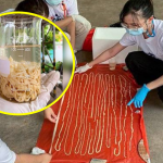 Lelaki Ngadu Sakit Perut Lepas Ke Hospital Ini Yg Dijumpai. NGERI! Lelaki Ngadu Sakit Perut Lepas Ke Hospital Ini Yg Dijumpai. NGERI!