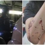 Wanita Diserang Cemas Apabila Lelaki Cuba Buka Seluar Wanita Diserang Cemas Apabila Lelaki Cuba Buka Seluar