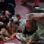 Dua Lelaki Melecur Teruk Terkena Minyak Bahan Api Dua Lelaki Melecur Teruk Terkena Minyak Bahan Api