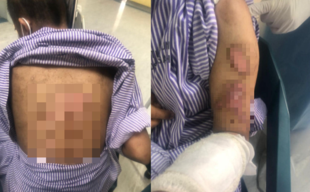 Bella Tidur Atas Lantai Tanpa Alas Di Bilik Dobi, Kesan Lecur Pada Leher- Saksi