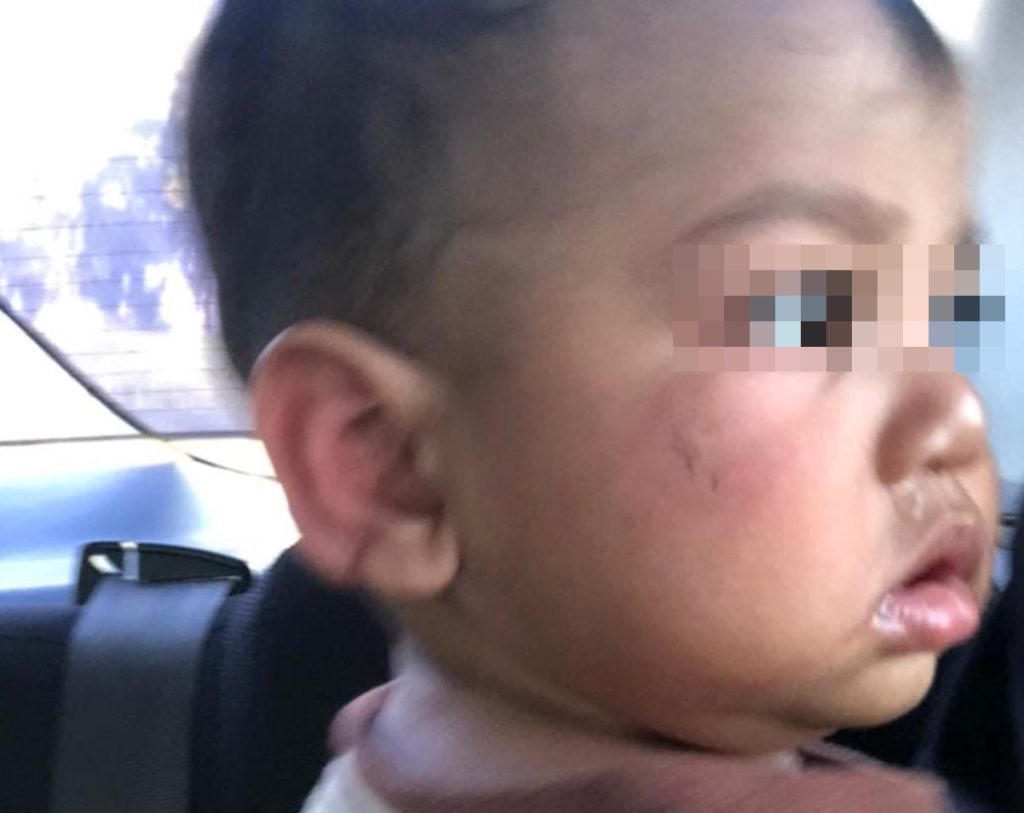 Tubuh Anak Penuh Luka Dan Gigitan. Ini LUAHAN Bapa Mangsa Terhadap Pusat Jagaan