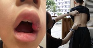 Ditumbuk, Dibuli Oleh Pelajar Lain Di Sekolah, PUNCANYA Tidak Masuk Akal Ditumbuk, Dibuli Oleh Pelajar Lain Di Sekolah, PUNCANYA Tidak Masuk Akal