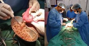 Doktor Terkejut Keluarkan Cacing 1kg Dari Usus Seorang Kanak-Kanak.