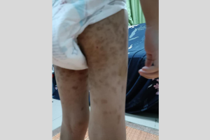 Hanya Sebab Tak Nak Makan, Lelaki Tergamak Dera Anak Angkat