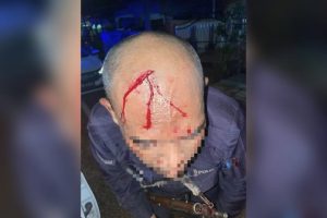 Dua Polis Cedera Akibat Diserang Lelaki Mabuk Guna Batu