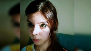 Dihukum Kerana Tatu Hitam Mata Gadis