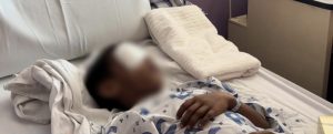 Budak Lelaki 9 Tahun Hampir Buta Sebelah Mata Akibat Main Mercun Buatan Sendiri